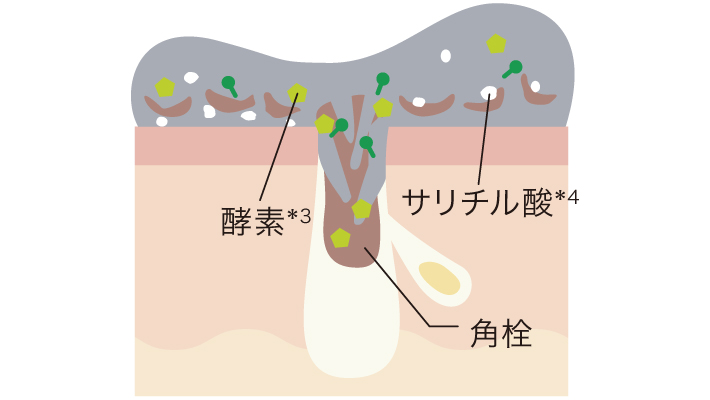 酵素が角栓を溶解し、サリチル酸が古い角質を軟化するイメージ